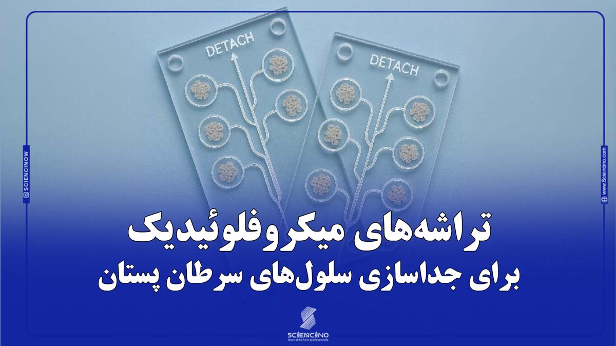 تراشه‌های میکروفلوئیدیک برای جداسازی سلول‌های سرطان پستان