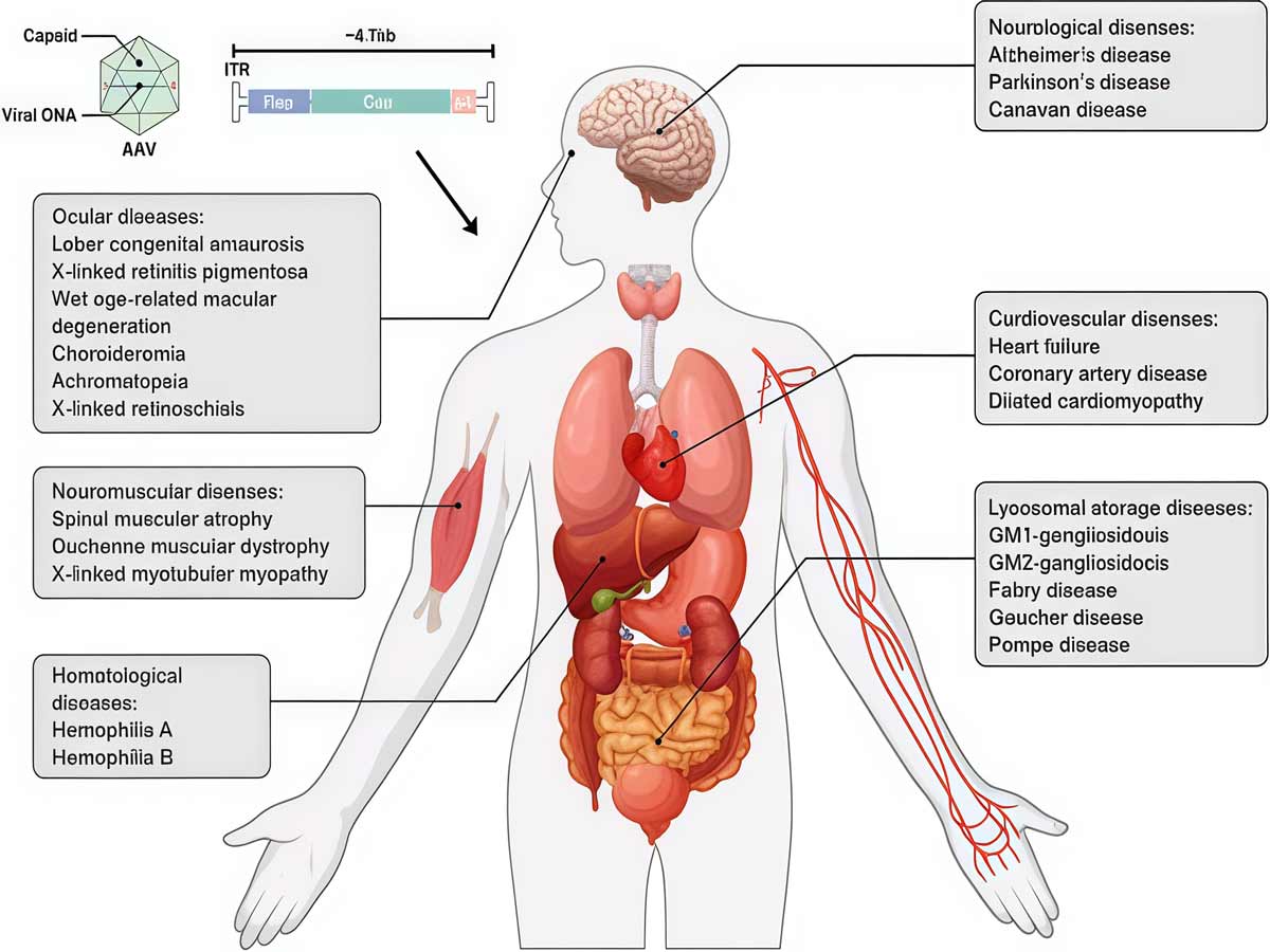 تصویر 4. کاربردهای بالینی و مطالعات AAVژن‌درمانی