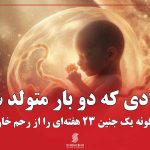 نوزادی که دو بار متولد شد